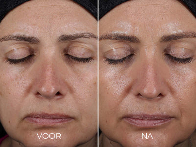 DAILY PREVENTION - Advanced Smartblend Mineral Moisturizer SPF 50+