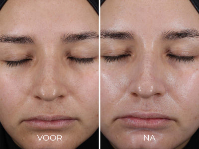 DAILY PREVENTION - Pure Mineral Hydrating Moisturizer SPF 30 | Image Skincare