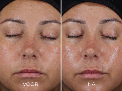 DAILY PREVENTION - Ultra Defense Moisturizer SPF 50 | Image Skincare