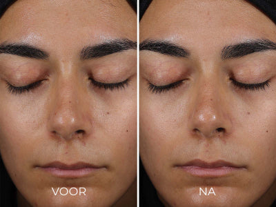 DAILY PREVENTION - Sheer Matte Moisturizer SPF 30 | Image Skincare